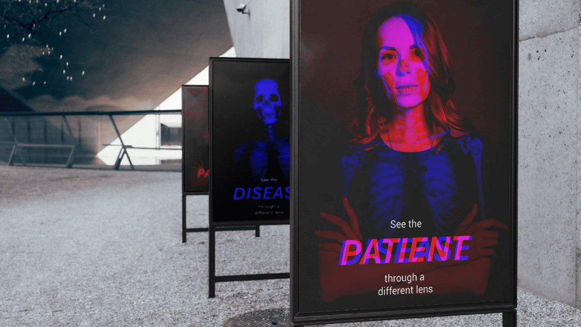 Images of poster panels from a medical campaign asking viewers to see the patient through a different lens